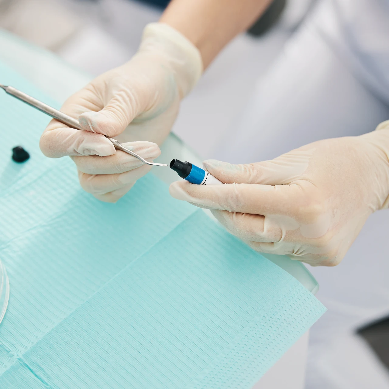Tooth-Colored Composite Fillings